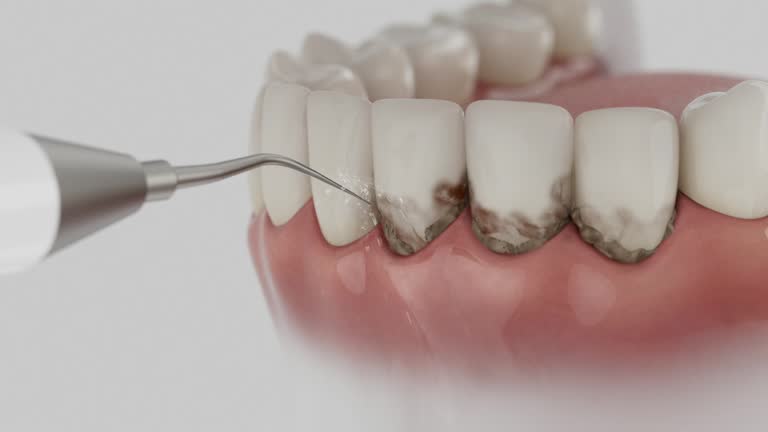 Reliable Wisdom Tooth Removal contractor in Ross County County, OH by Dentist Open Now